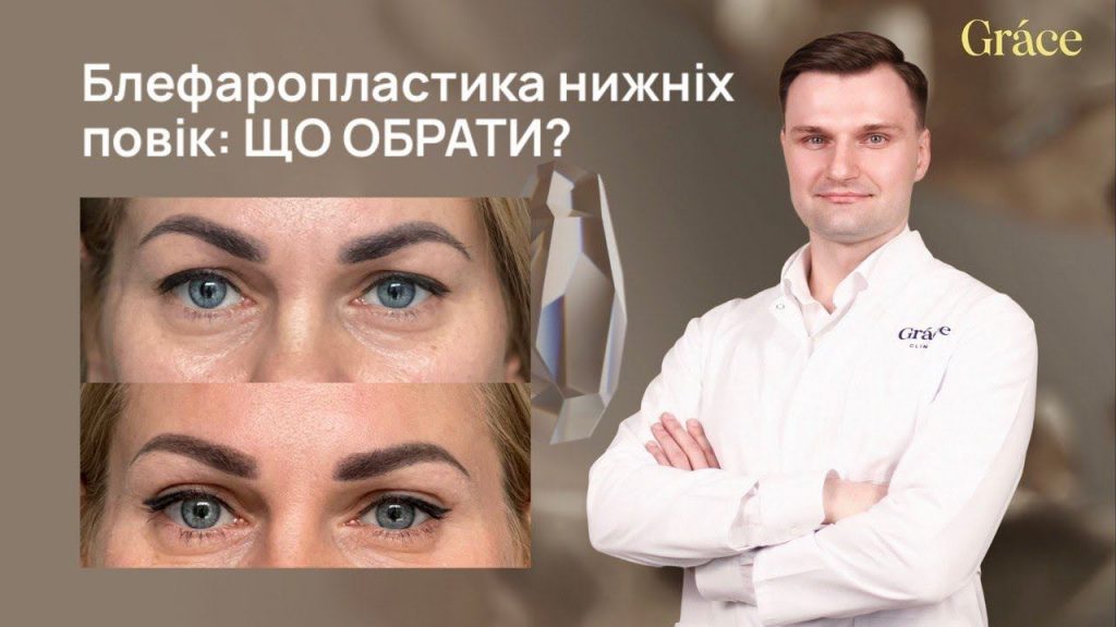 Блефаропластика нижніх повік | Який метод обрати?