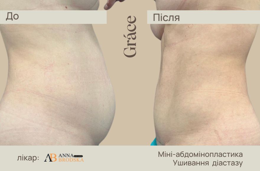 До / после хирурга