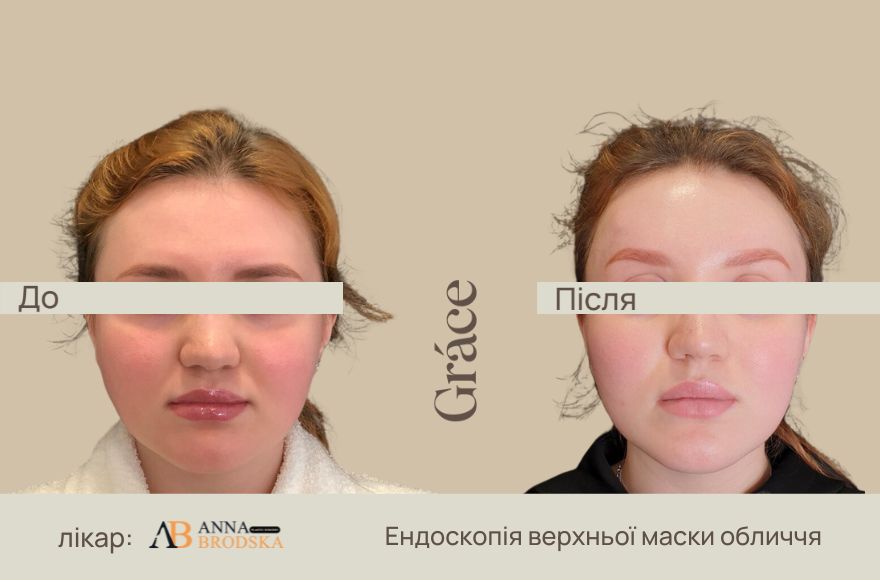 До / после хирурга
