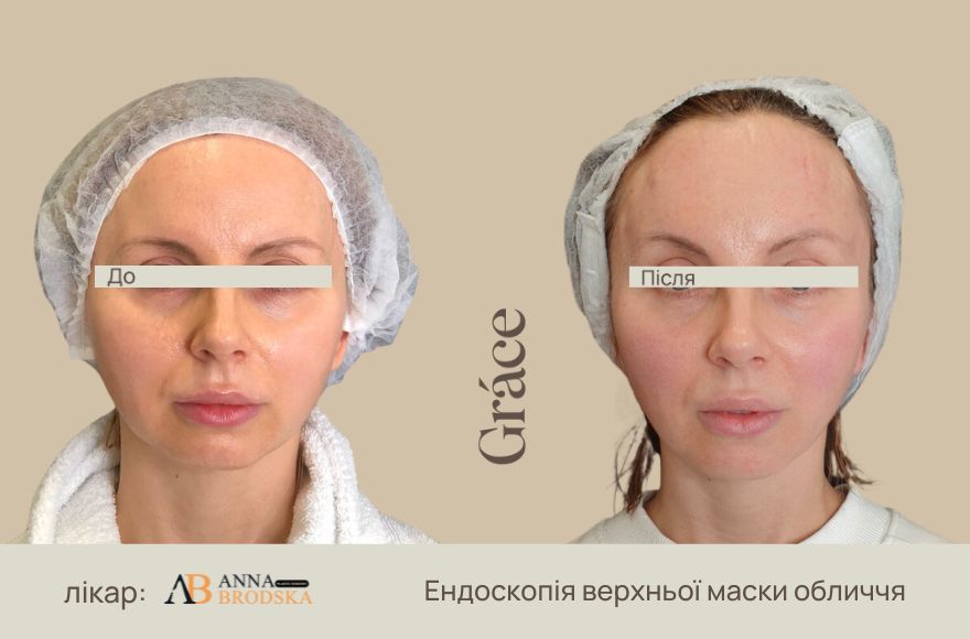 До / после хирурга