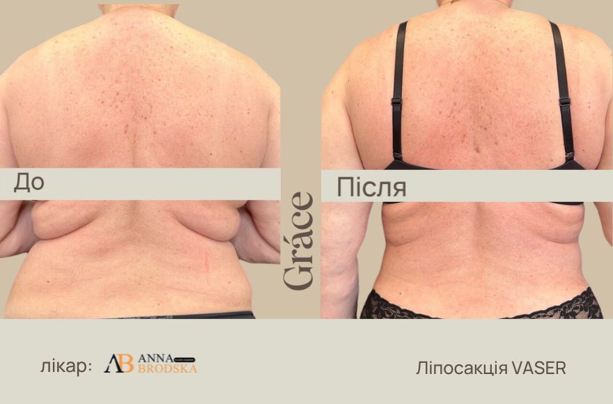 До / после хирурга