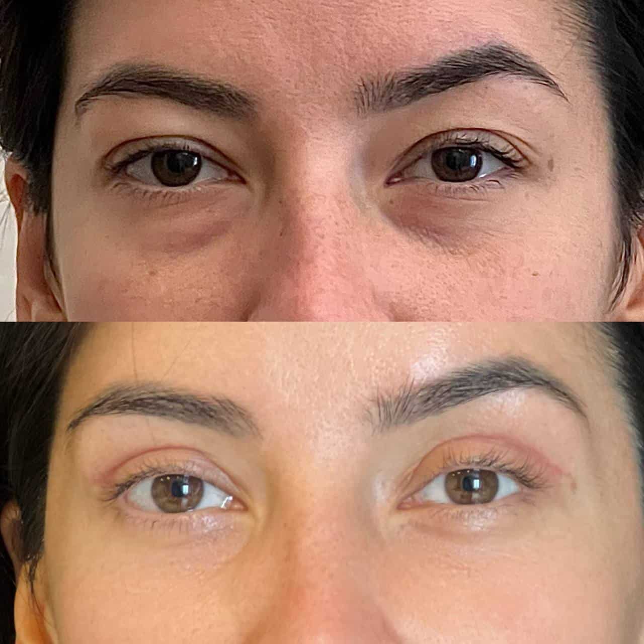 До після хірурга