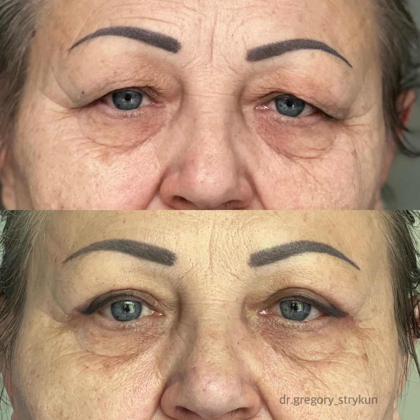 До після хірурга