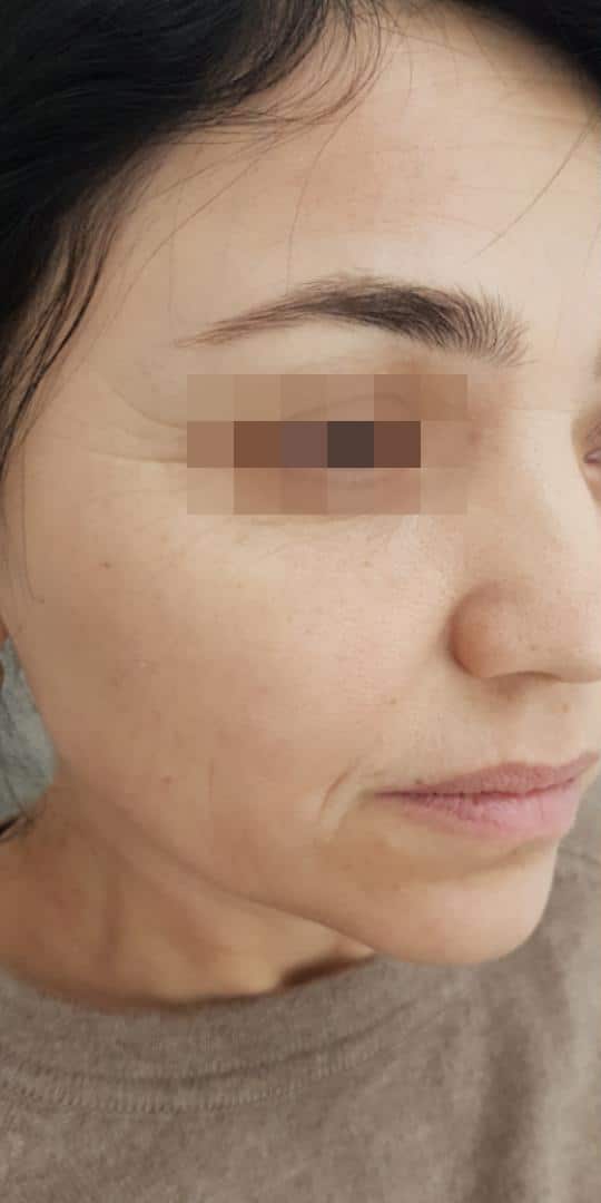 Before & after
