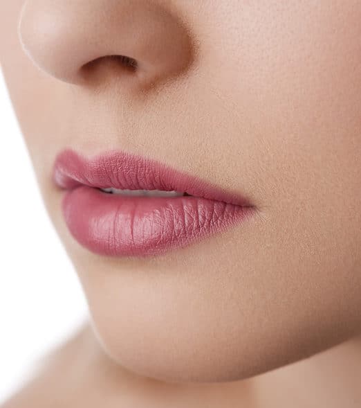 Nasolabial fold correction