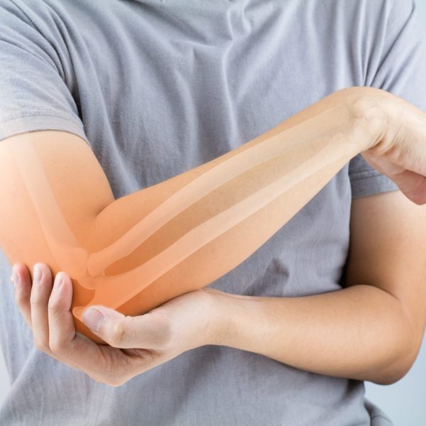 Osteosynthesis for bone fractures
