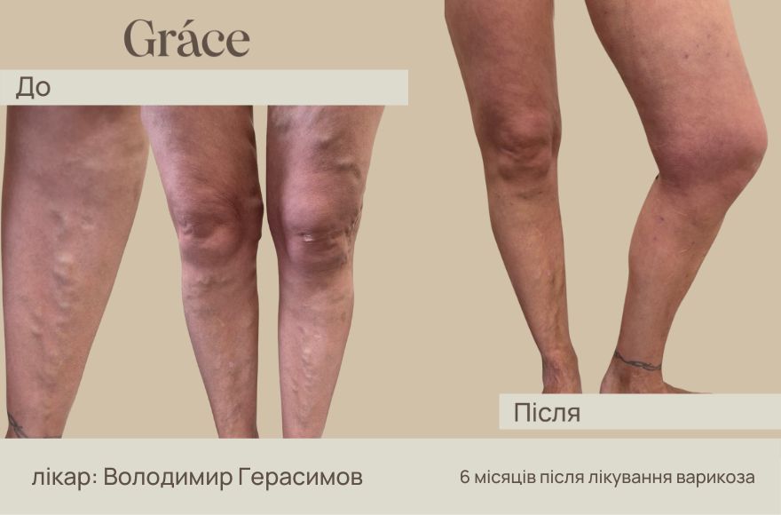 До після лікаря