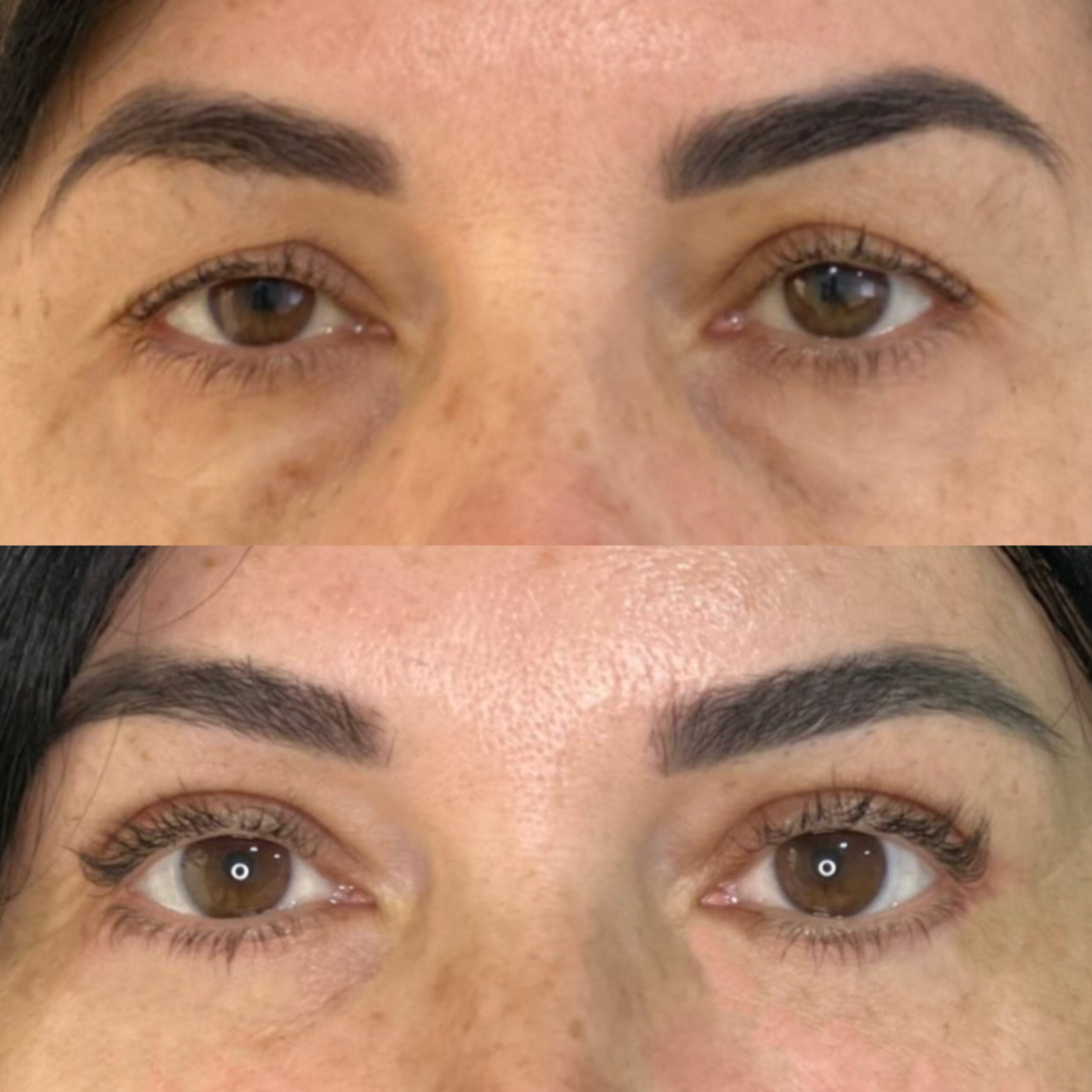 До після хірурга