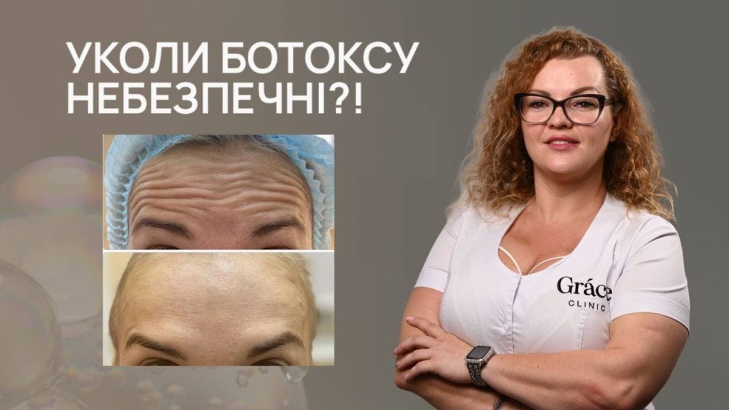 Уколи ботоксу небезпечні?! Ускладнення після ботоксу