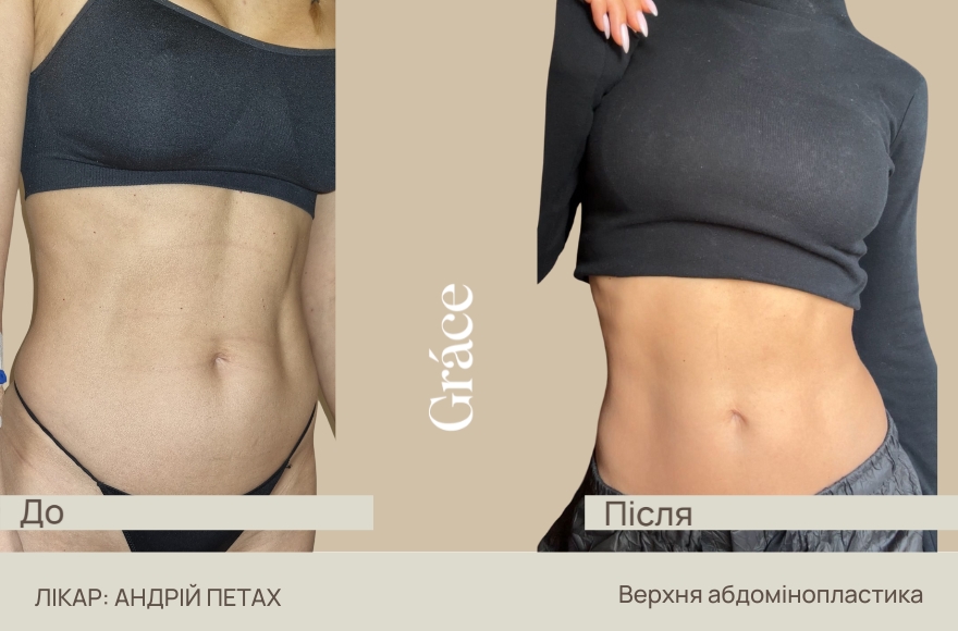 До / після хірурга