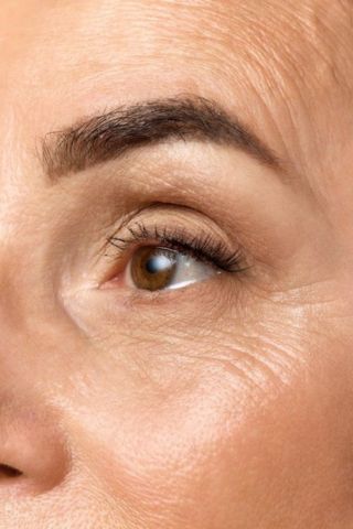 Як позбутися малярних мішків (суфів) на вилицях: інноваційні методи усунення в Grace Clinic