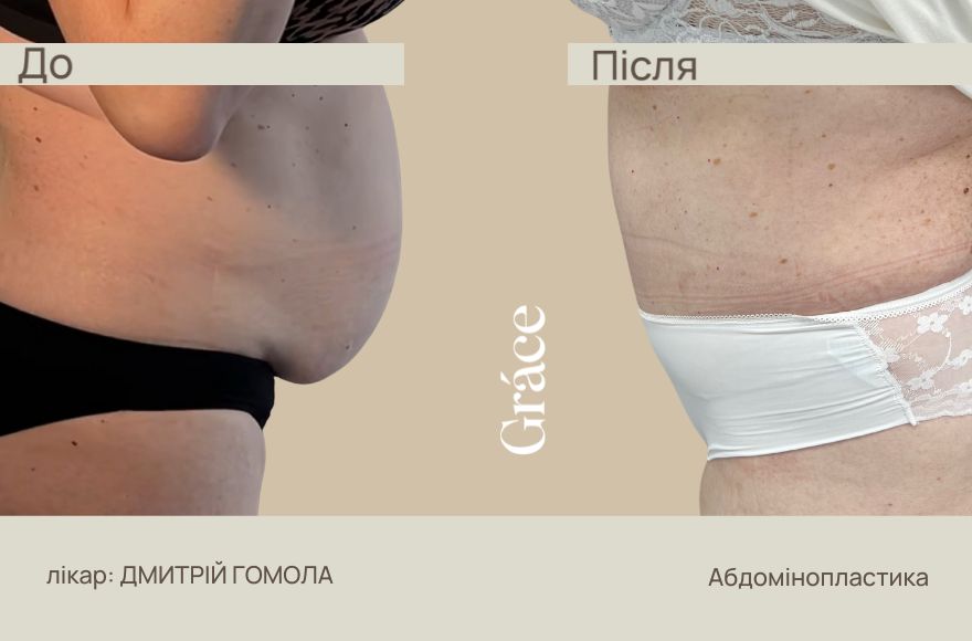 До / після хірурга