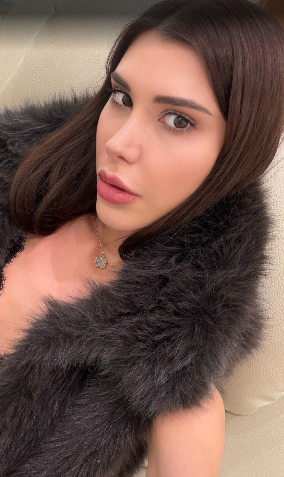 Я сделала повторную ринопластику у доктора Компаниеца, чтобы исправить свой «нос Майкла Джексона» 