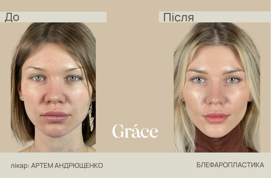 Before / after surgery